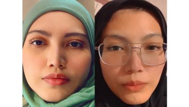 Photo of Berat Elyana Kini Hanya 35 Kilogram, Akan Buat CT Scan Sebelum Jalani Rawatan Radioterapi