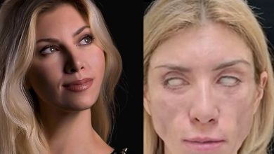 Photo of Mahu Kelihatan Cantik… Bekas Peserta Ratu Cantik Rusia Kini Derita Wajah Jadi Hodoh Lepas Jalani Pembedahan Plastik