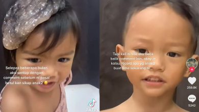 Photo of Alat Mainan Slime Tersangkut Atas Kepala, Ibu Nekad Potong Pendek Rambut Anak Perempuannya