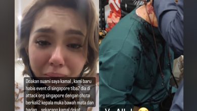 Photo of Kamal Adli Kena Serang Di Singapura, Dipukul Dengan Cota Berkali-Kali Sehingga Alami Kecederaan Parah Di Kepala