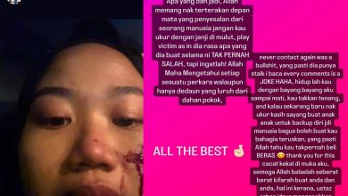 Photo of “Thank You For This Cacat Kekal Di Muka Aku…” – Shuhada Luah Perasaan Selepas Insiden Ditumbuk Hafidz Roshdi