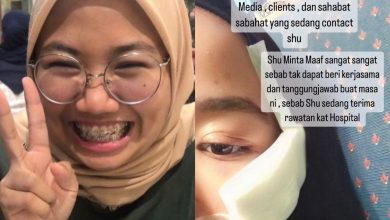 Photo of Belum Sempat Dedah Jadi Mangsa Penyondol, Bekas Isteri Hafidz Roshdi Tunjuk Gambar Alami Kecederaan Di Muka… Kini Sedang Dirawat Di Hospital